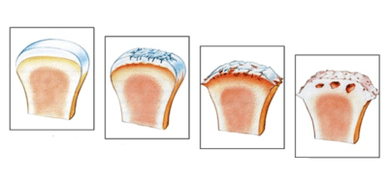 Αιτιολογικό
