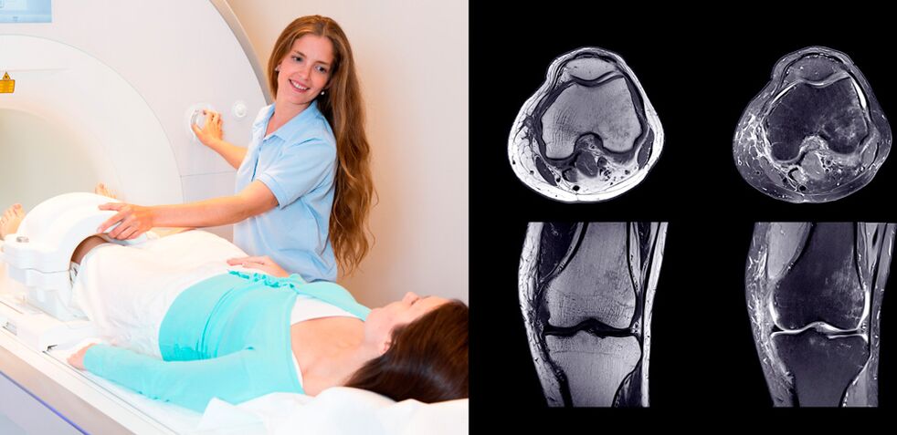 Διάγνωση άρθρωσης γόνατος