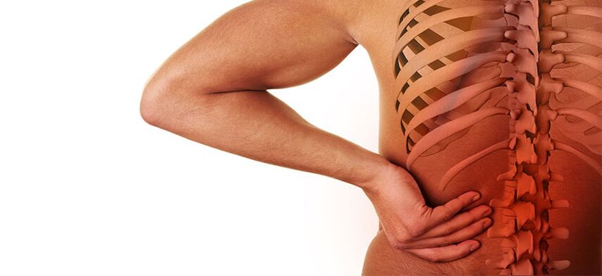 Συμπτώματα οσφυϊκής οστεοχονδρωσίας